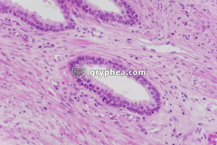 Prostate x100 - gryphea.com